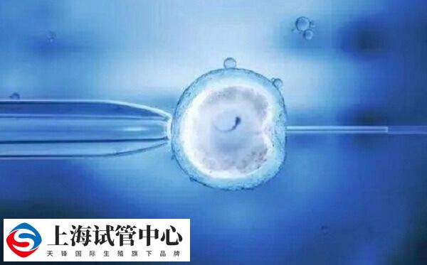 试管拮抗剂方案费用低