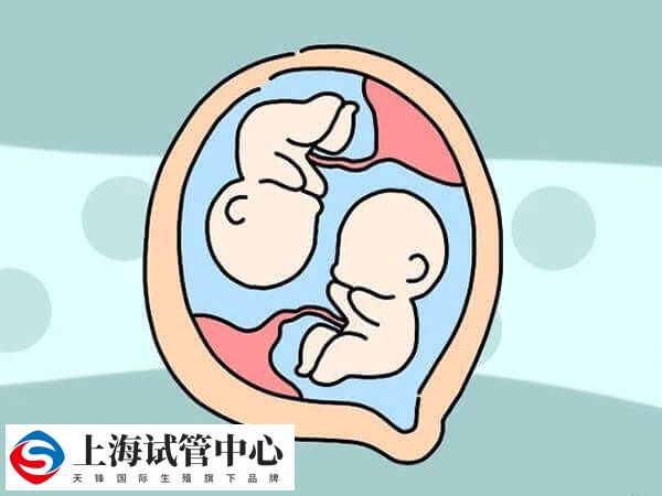 胚胎是男性或女性也是一个随机事件