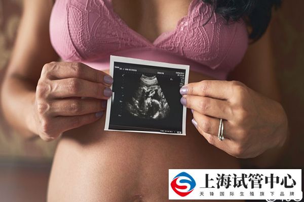 二维彩超检查目的