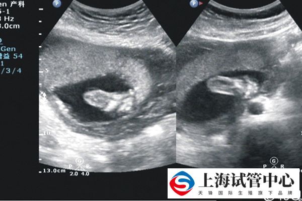 黑白呈像的检查单