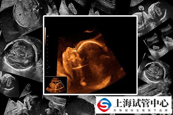 四维彩超的优势