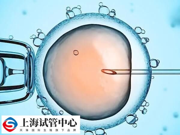 系统性红斑狼疮能做试管婴儿