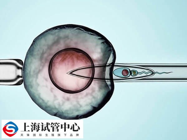 试管婴儿的报销政策在不同地区有所不同