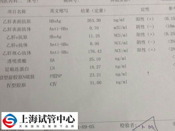 乙肝大三阳是指人体三项乙肝病毒免疫指标